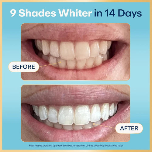 Lumineux Teeth Whitening Strips